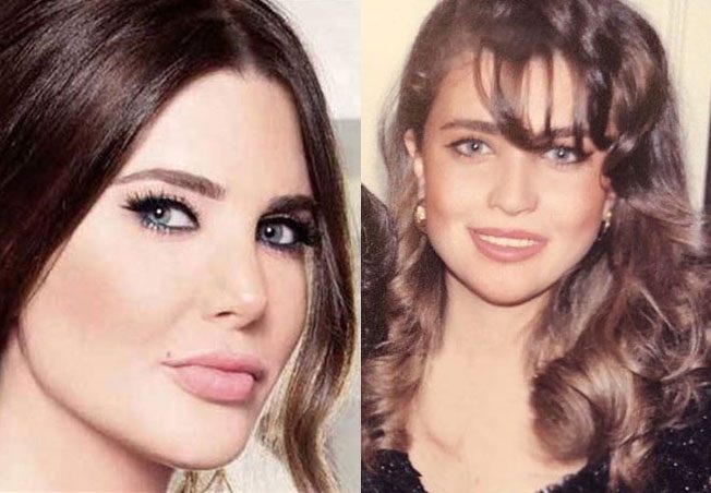 نادين نسيب نجيم قبل التجميل
