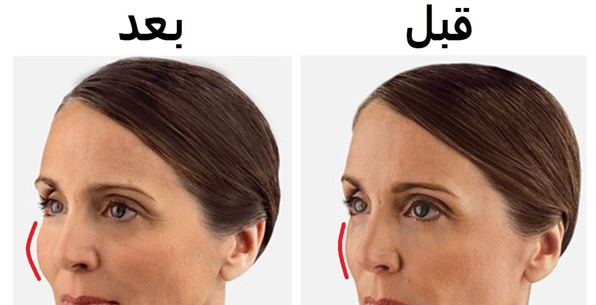 بمكونين من مطبخك تحصلين على خدود مشدودة ومنتفخة خلال 10 دقائق.. تأثيرهما كالبوتوكس!
