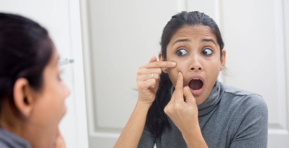 الفازلين يخلصك نهائياً من الرؤوس السوداء