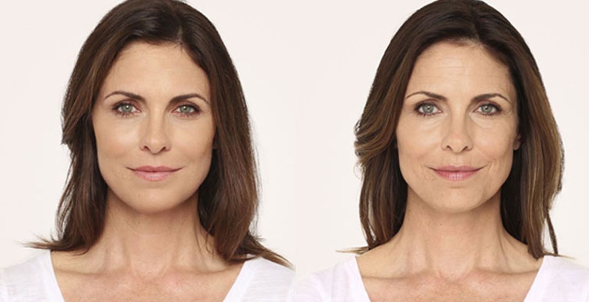 لبان الذكر للتجاعيد