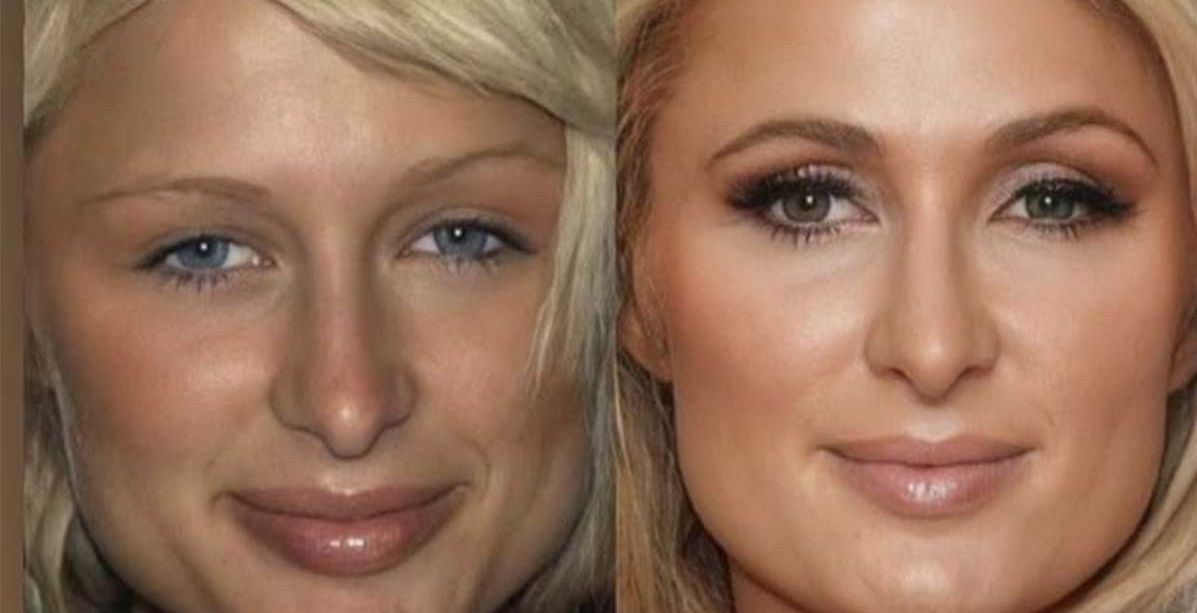 صور من مراهقة النجمات تظهر التغير الذي سببته عمليات التجميل