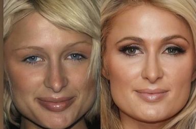 صور من مراهقة النجمات تظهر التغير الذي سببته عمليات التجميل