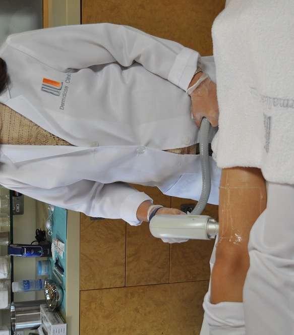 Soprano Ice...الآلة الأهم في العيادة