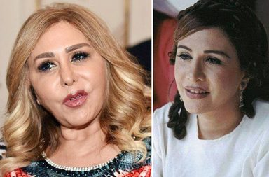 نجمات سوريا وعمليات التجميل: ناجحة عند البعض وتشوهات مخيفة عند البعض الآخر..إليك الصور: