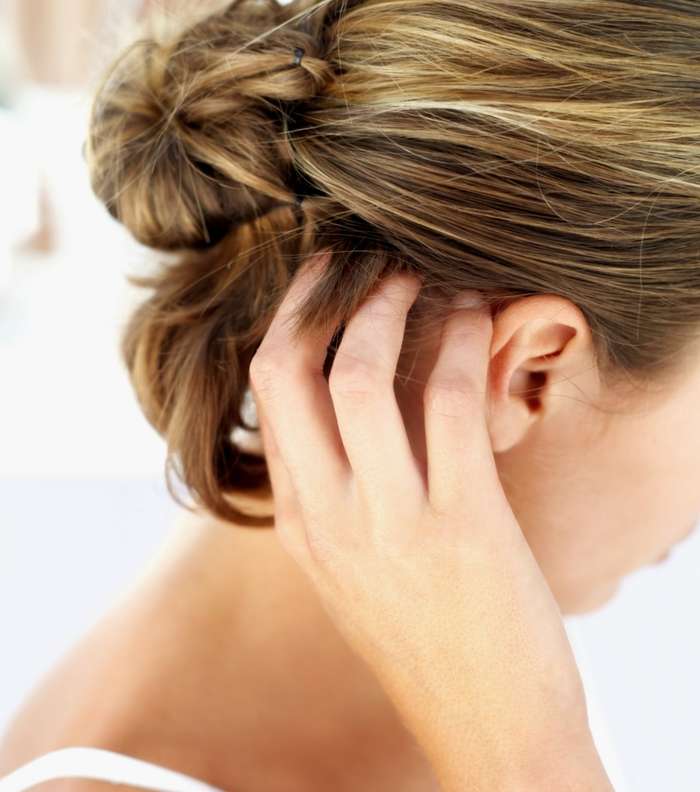 هل تعانين من مشكلة القمل؟ تخلّصي منها بواسطة الليمون