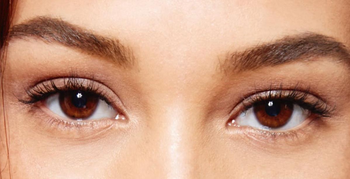 اسباب تجاعيد تحت العين في سن صغير