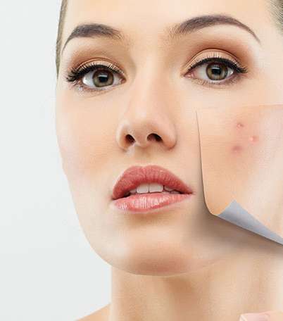 بالصور، أسبابٌ غريبة لظهور حب الشباب