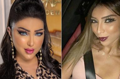 نجمات بالغن في عمليات التجميل وأفسدن شكلهن