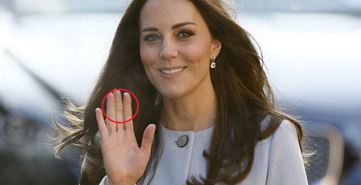 لماذا تضع كيت ميدلتون ضمادات الجروح دائماً على أصابعها؟