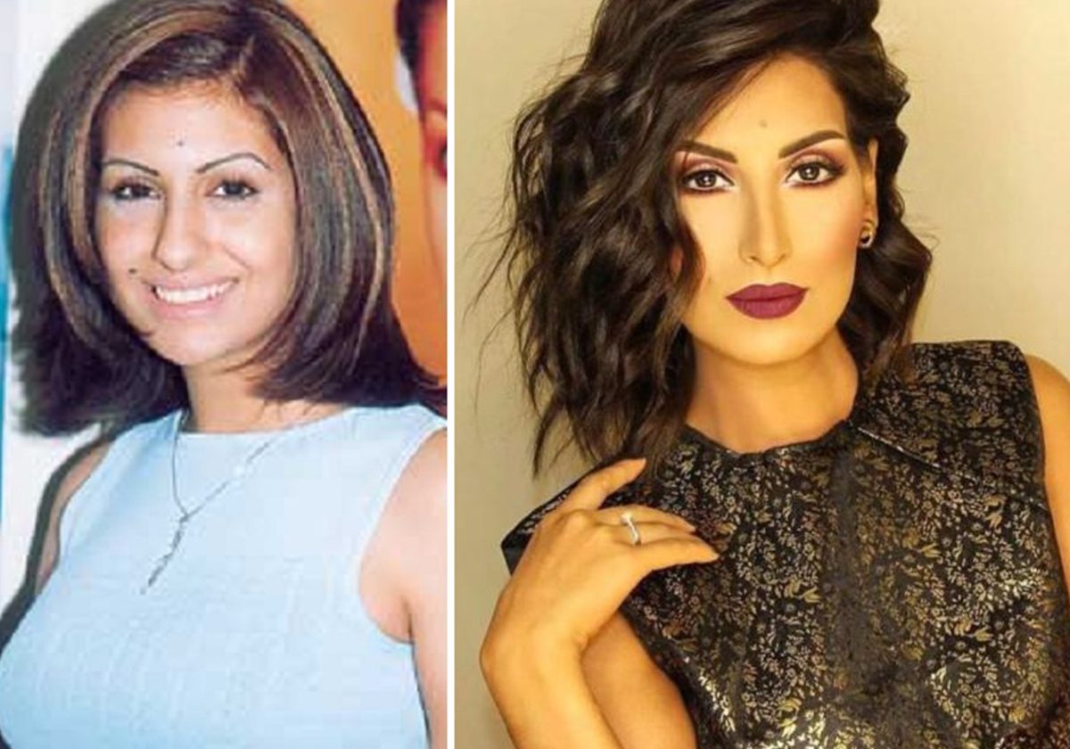 رويدا عطية قبل وبعد