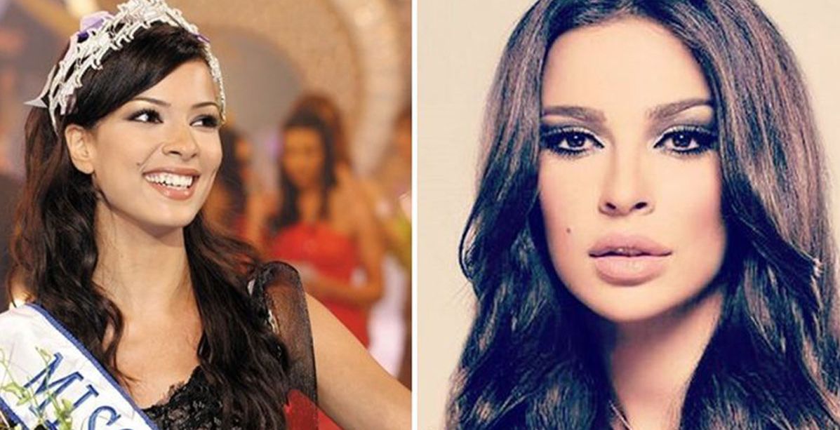 صور صادمة للنجمات العربيّات قبل عمليات تكبير الشفاه وبعدها!