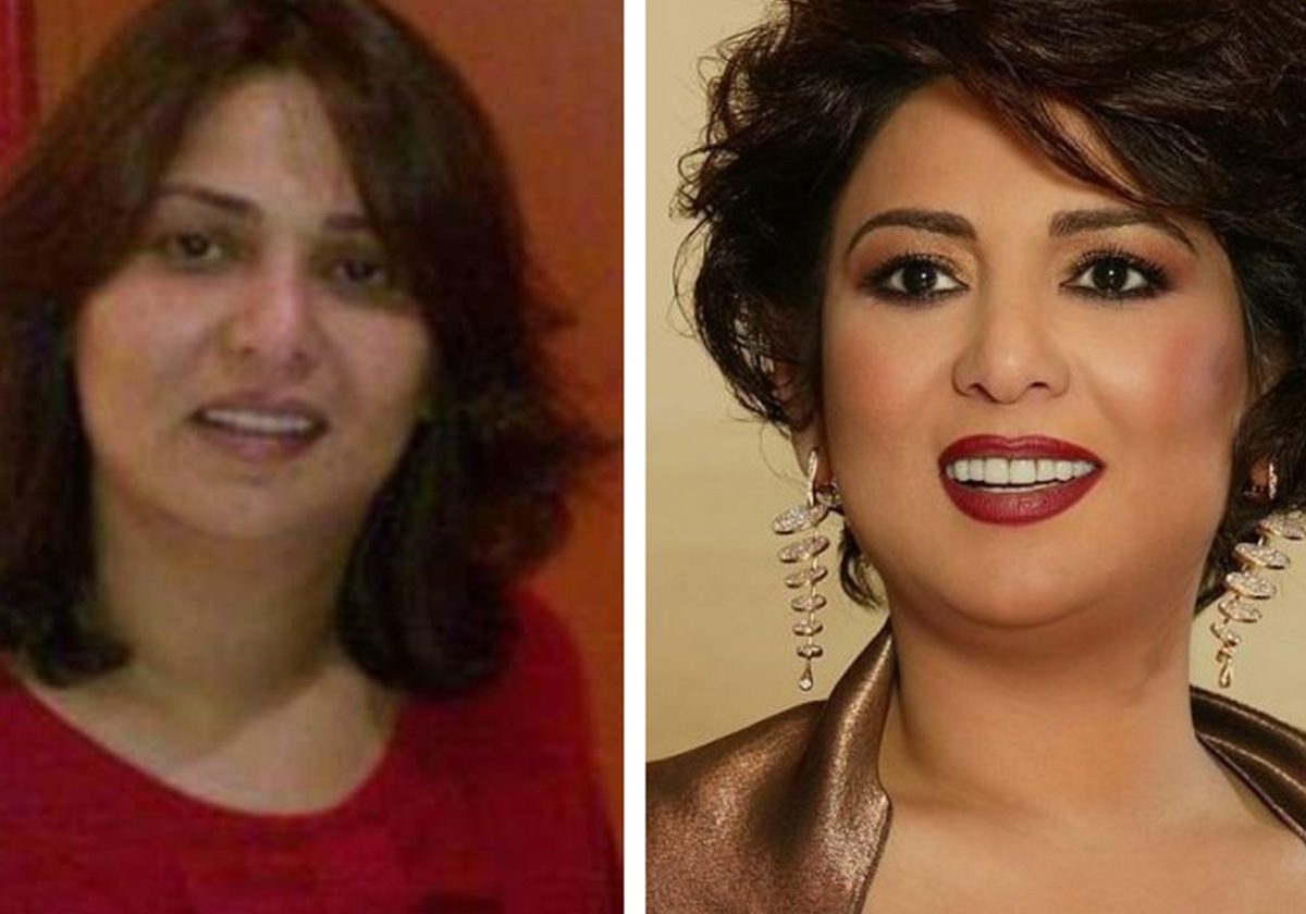 نوال الكويتية من دون ماكياج