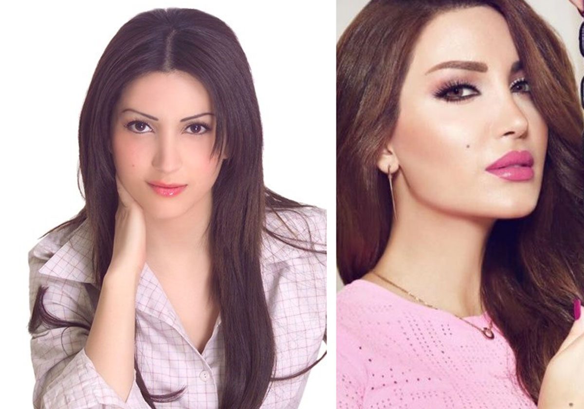 نسرين طافش قبل التجميل وبعده