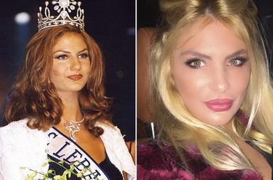 بالصور، ملكات جمال لبنان قبل التجميل وبعده