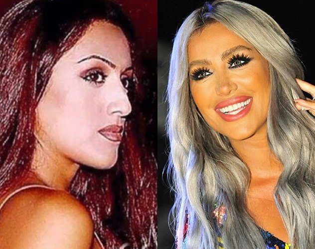 أكثر 4 نجمات عربيات تغيرن بشكل مفاجئ بعد عمليات التجميل
