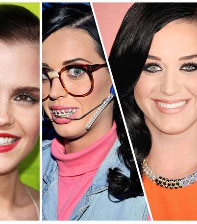 نجمات هوليوود بمقوّم الأسنان