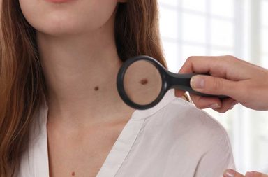 امور تكشفها الشامة عن شخصيتك حسب موقعها في جسمك