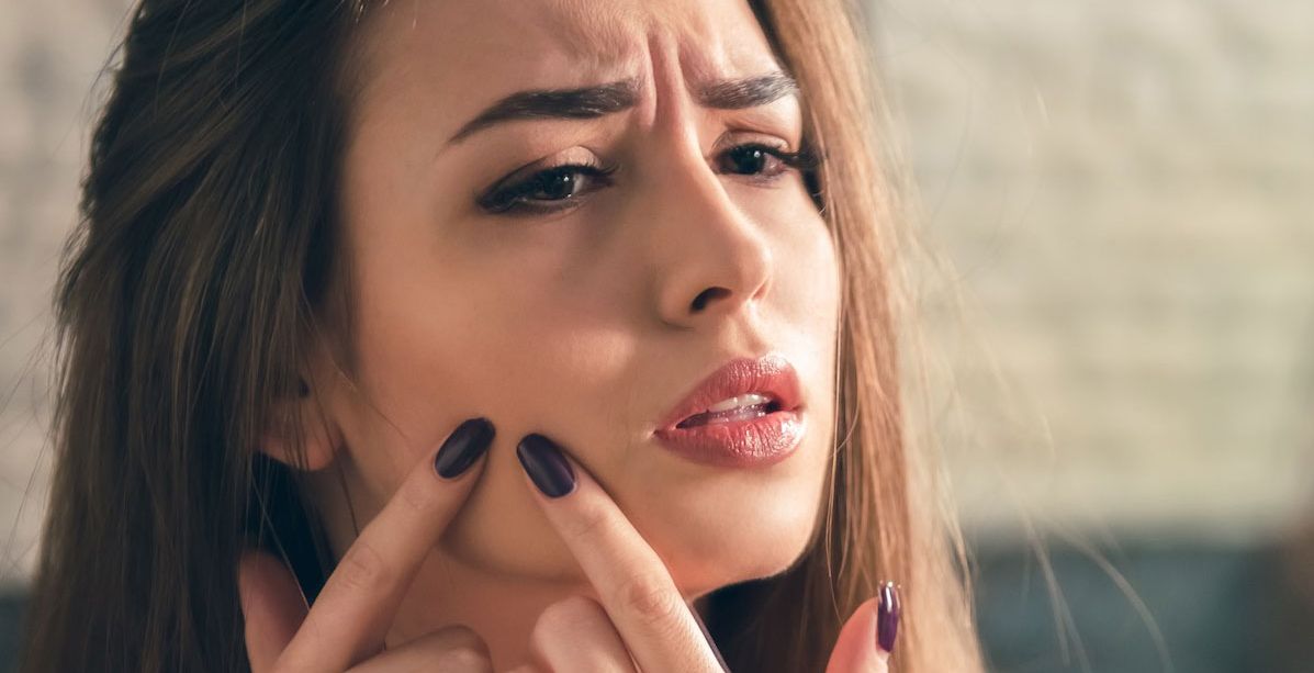 اسباب حبوب الشباب 