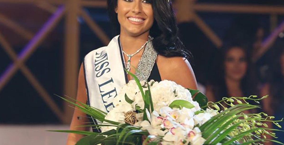 لن تصدّقي كيف أصبحت ملكة جمال لبنان 2013 كارين غراوي بعد عمليّات التجميل!