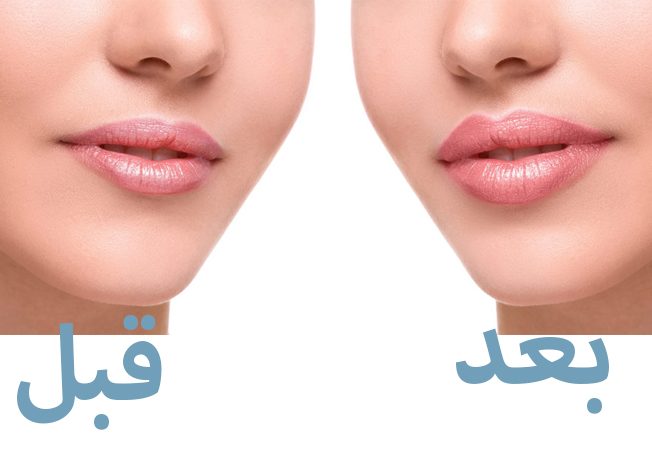 حيلة واحدة تكبّر الشّفاه بأسلوب طبيعي