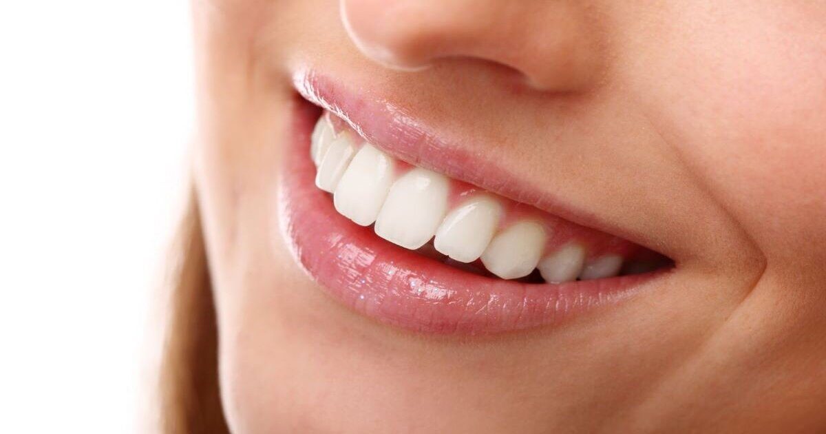 خصائص إبتسامة الأرنب